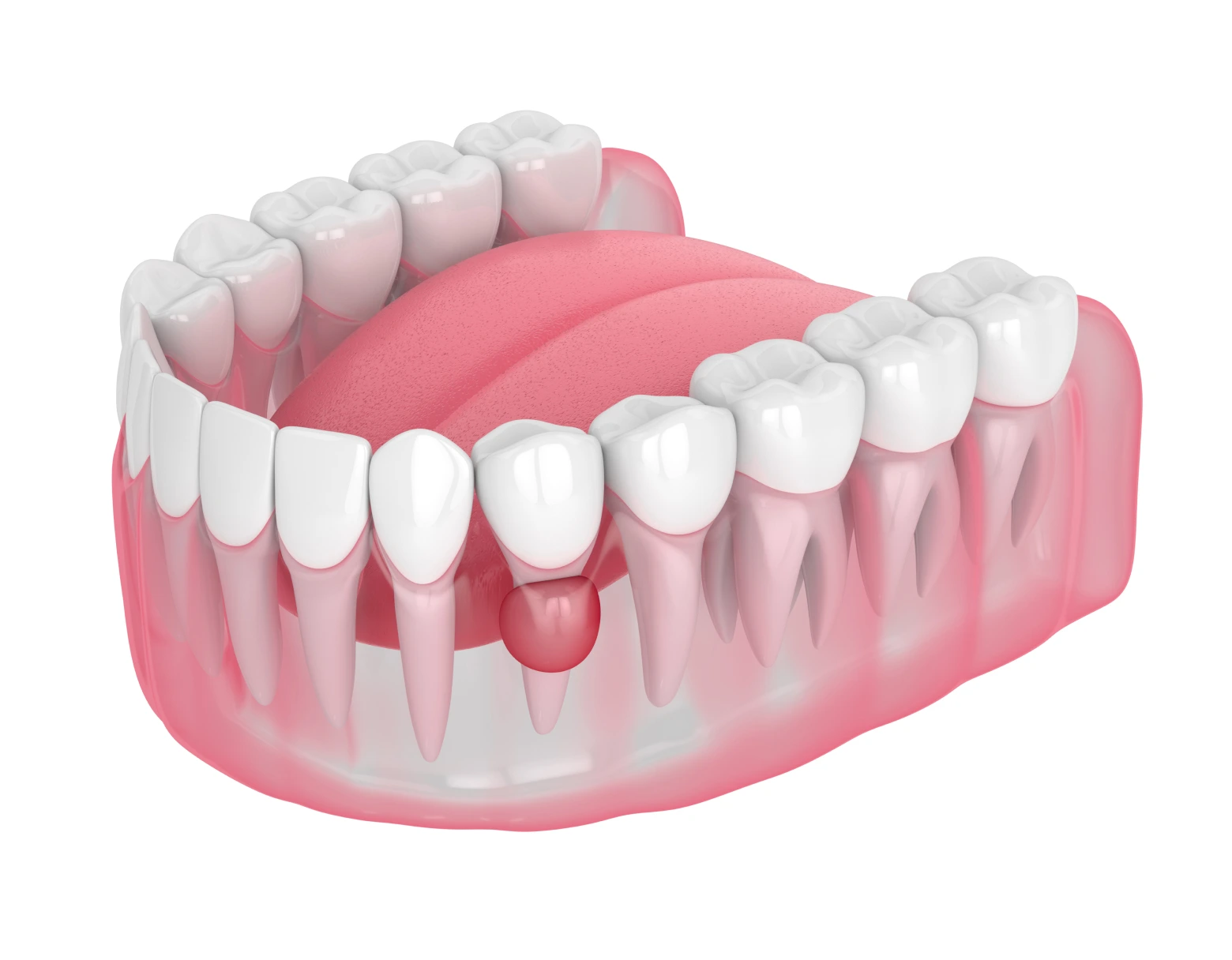 3D illustration of dental model showing healthy teeth and gums with emphasis on periodontal health, highlighting potential gum issues related to periodontics.